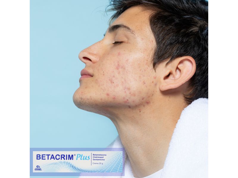 Betacrim-Plus-Tubo-20G-9-37903